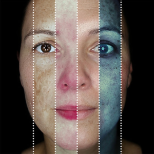 DIAGNÓSTICO Y ANÁLISIS PROFUNDO DE LA PIEL